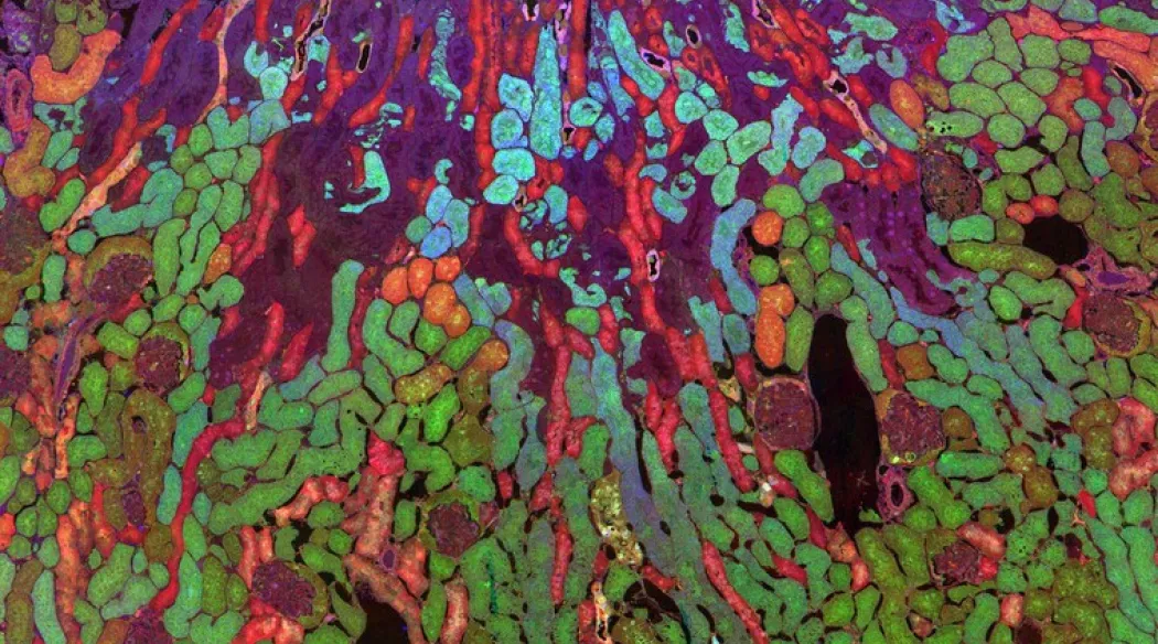 Zdjęcie rozmieszczenie metabolitów w nerce myszy
