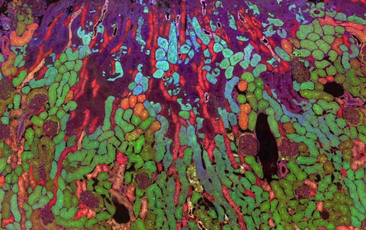 Zdjęcie rozmieszczenie metabolitów w nerce myszy